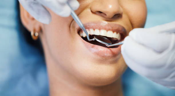 Best Broken or Chipped Tooth Repair in Laurel Hill, NC
