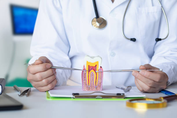 Best Knocked-Out Tooth (Avulsed Tooth) Treatment in Laurel Hill, NC