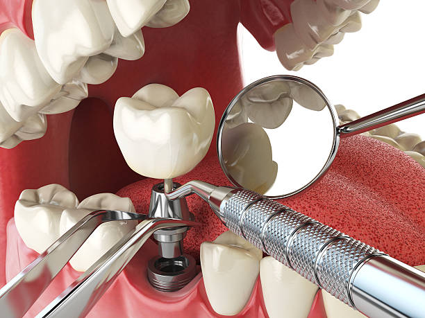 Best Weekend Emergency Dental Services in Laurel Hill, NC